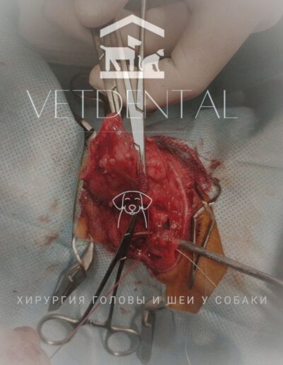 лазерное лечение