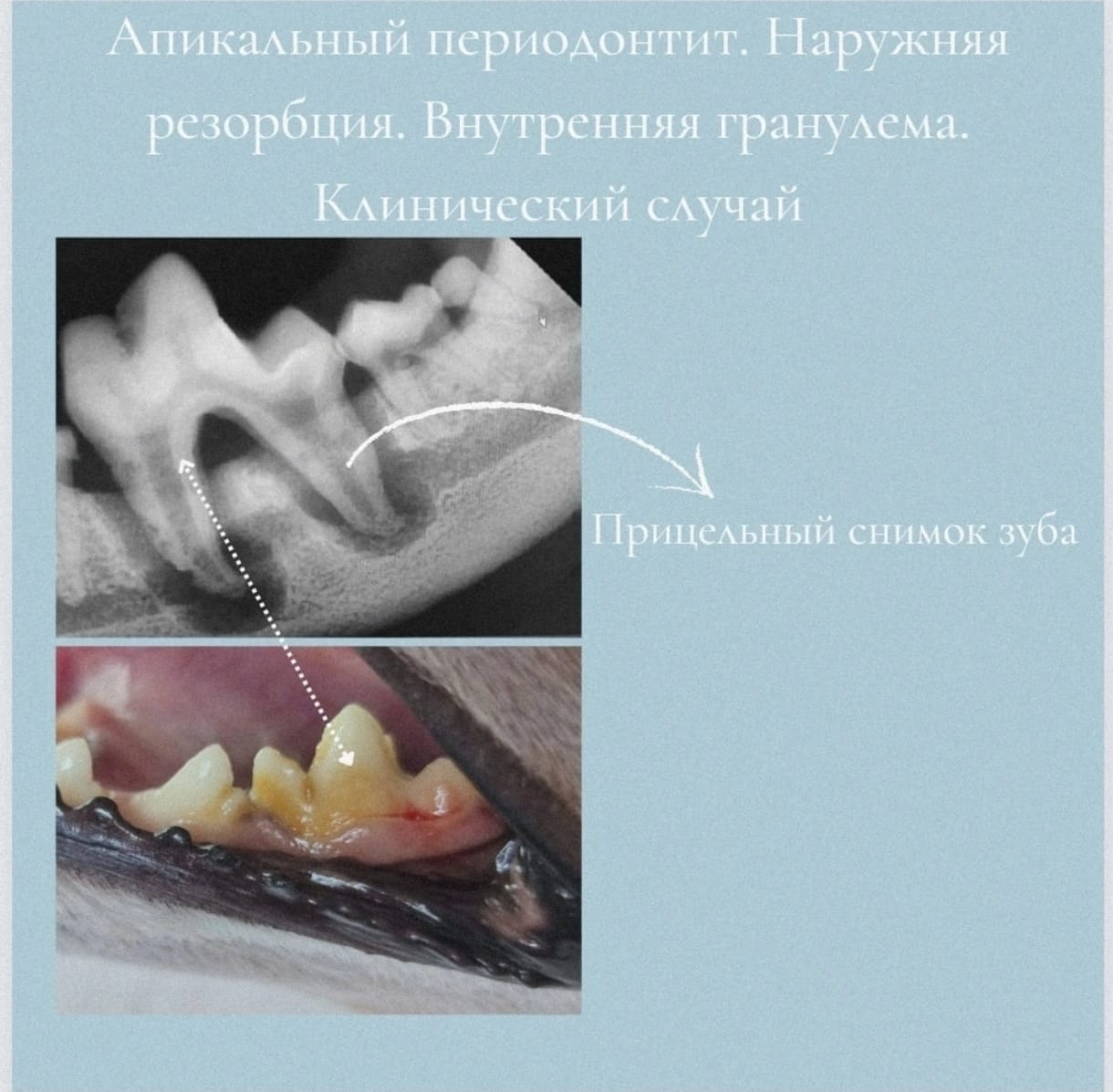 Скрытые патологии