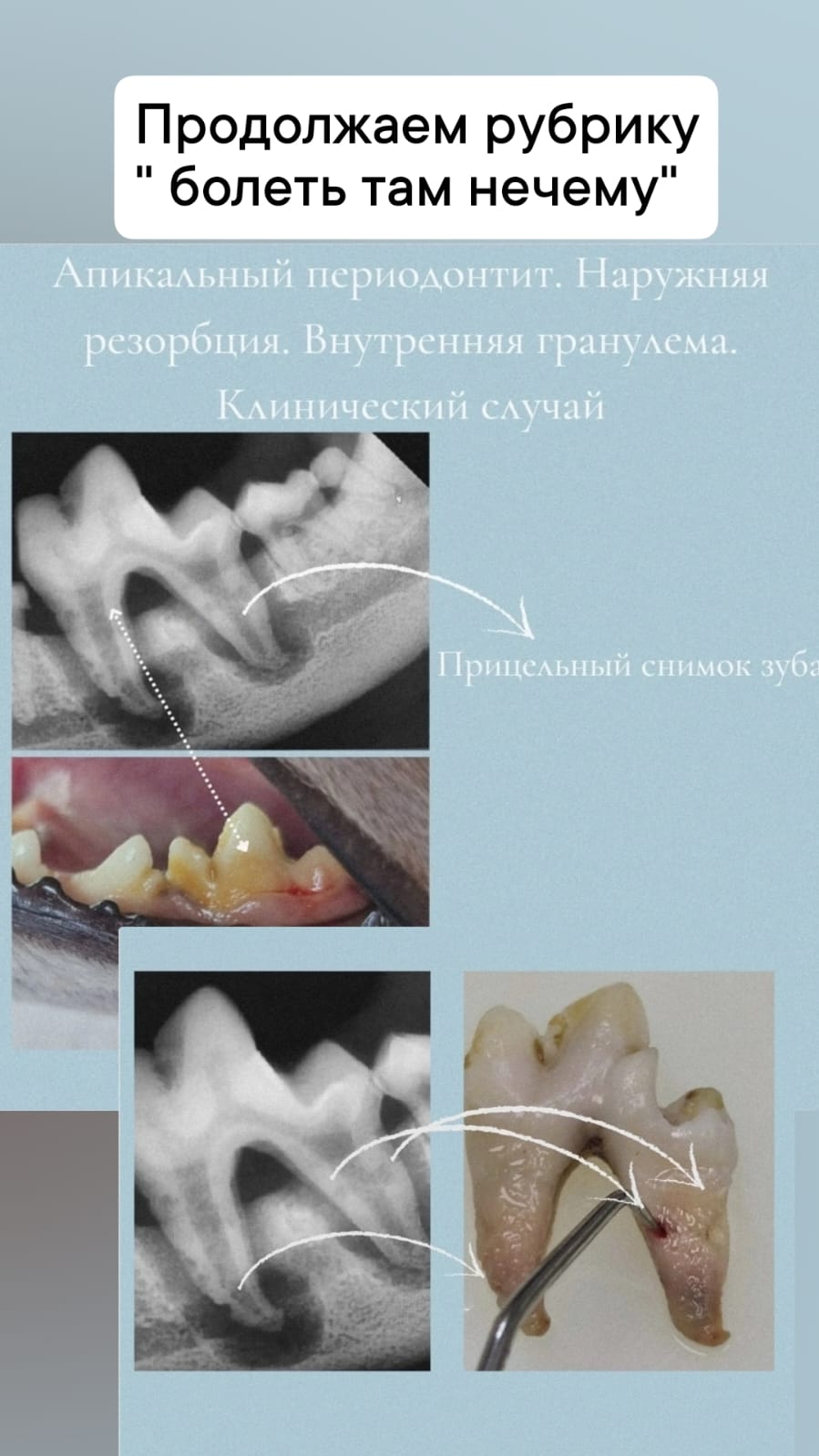 Скрытые патологии