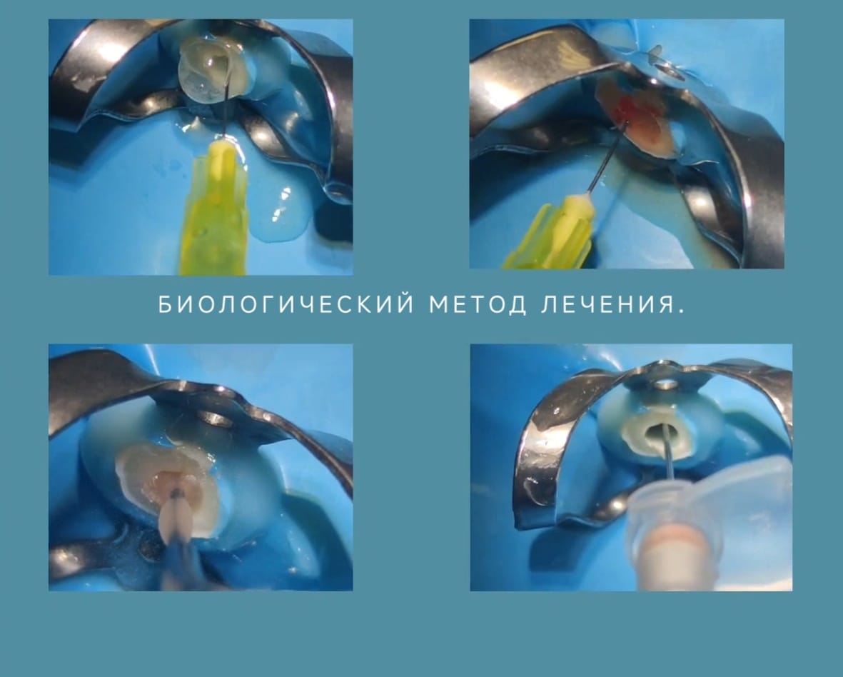 Биологический метод Биологический метод