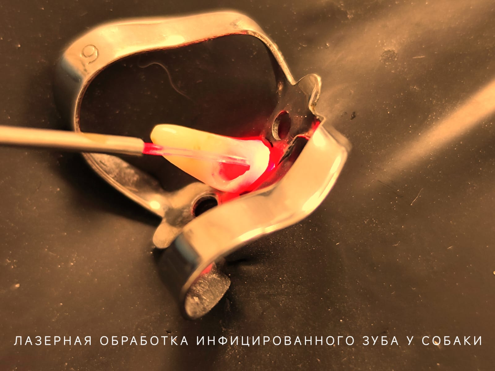 физиотерапия физиотерапия